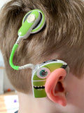 Tube twist for cochlear implants and hearing aids